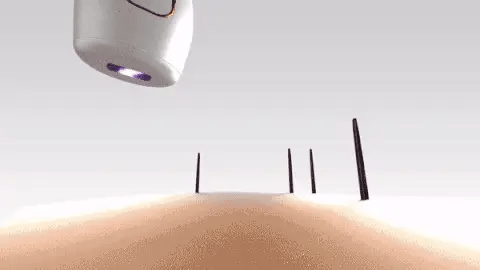 Hair Removal Portable IPL